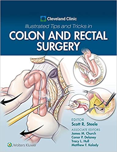 Cleveland Clinic Illustrated Tips and Tricks in Colon and Rectal Surgery – eBook PDF