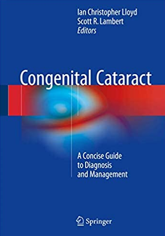 Congenital Cataract: A Concise Guide to Diagnosis and Management, ISBN-13: 978-3319278469