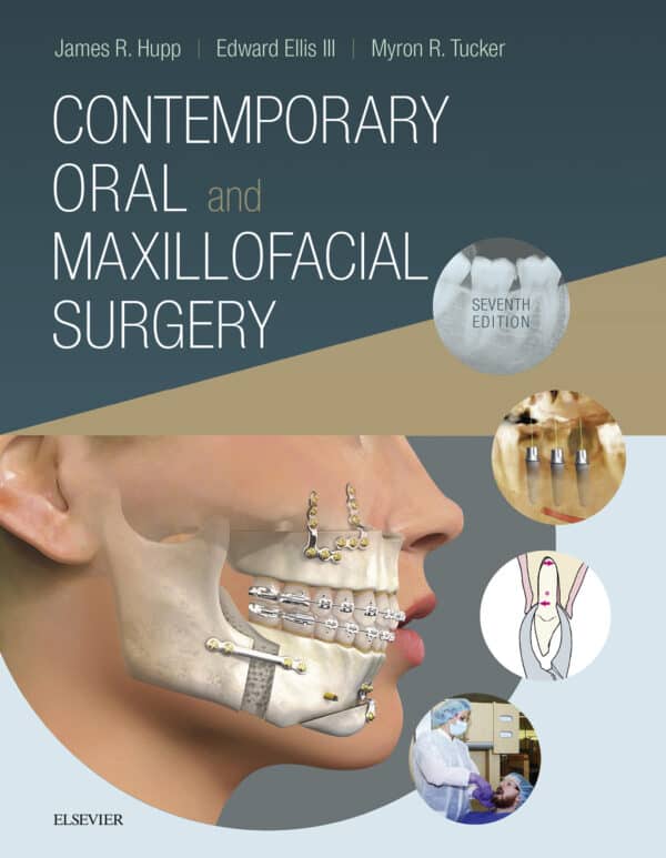 Contemporary Oral and Maxillofacial Surgery (7th Edition) – eBook PDF