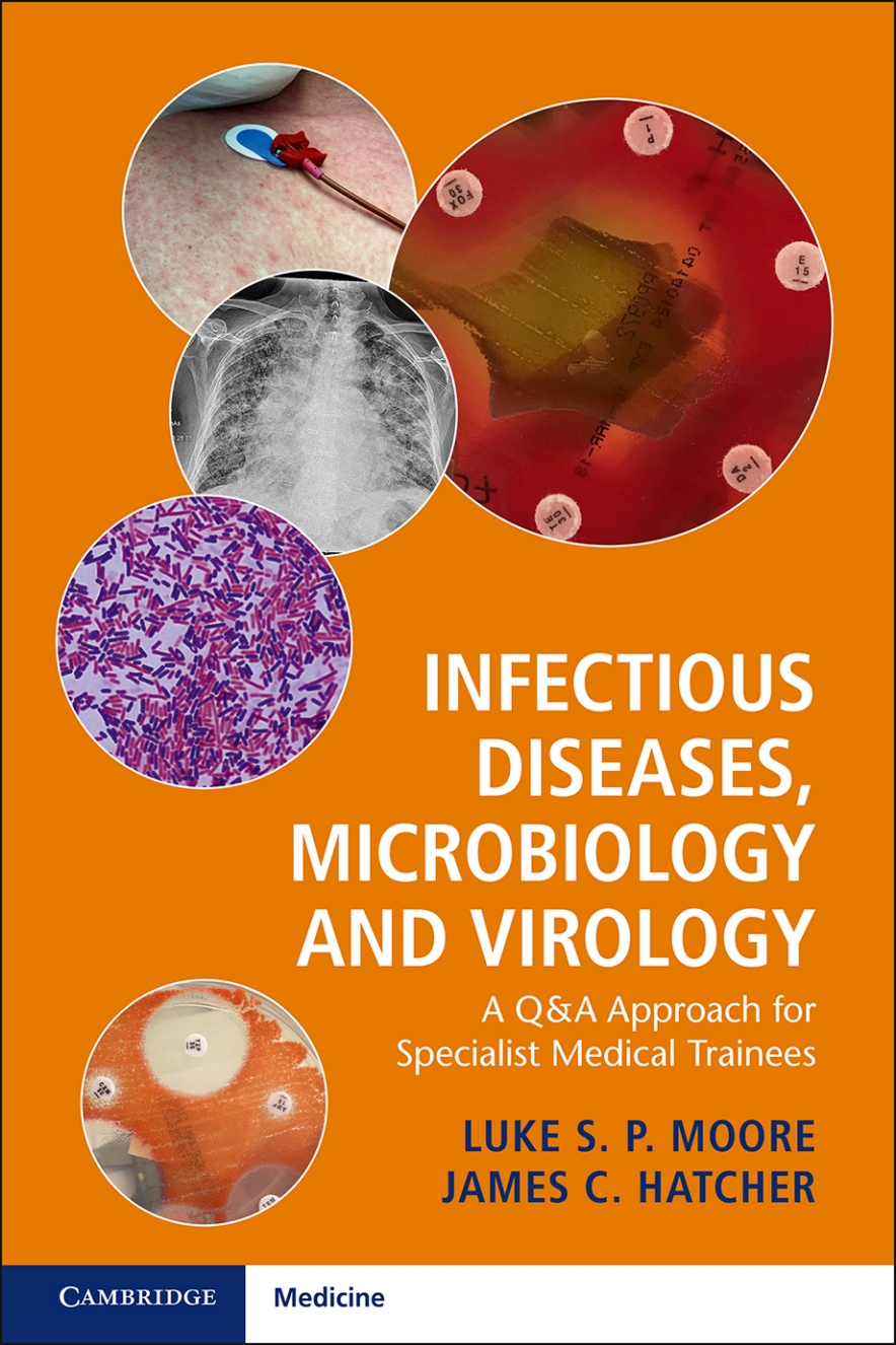 Infectious Diseases, Microbiology and Virology – eBook PDF