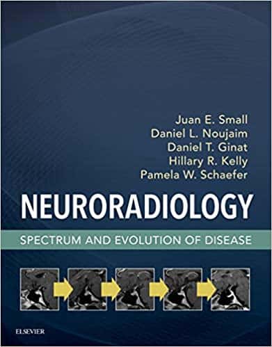 Neuroradiology: Spectrum and Evolution of Disease – eBook PDF