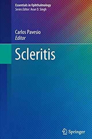 Scleritis (Essentials in Ophthalmology) 2017 Edition Carlos Pavesio, ISBN-13: 978-3319499130