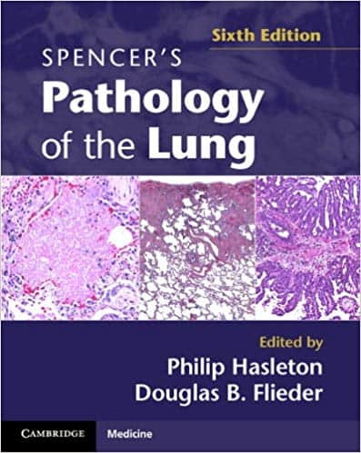 Spencer’s Pathology of the Lung (6th Edition) – eBook PDF