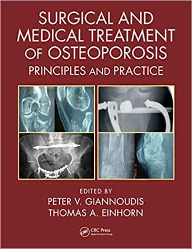 Surgical and Medical Treatment of Osteoporosis: Principles and Practice – eBook PDF