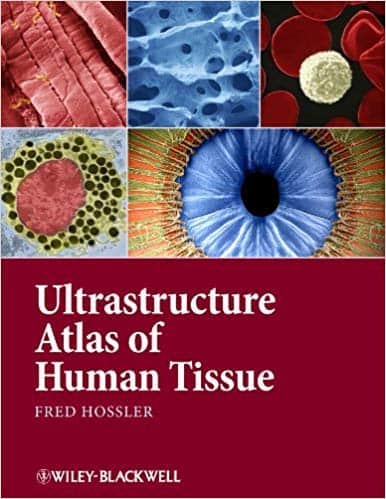 Ultrastructure Atlas of Human Tissues – eBook PDF